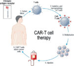 Car-T cell treatment in the country