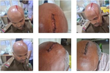 Armed Suspect arrested by magadi road police for attacking cop with rod