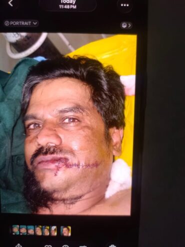 Two Rival Gangs Clash in JC Road,Three Seriously Injured